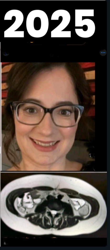 Dr. Ana Rosa After photo
