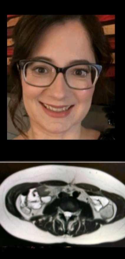 Dr. Ana Rosa After photo