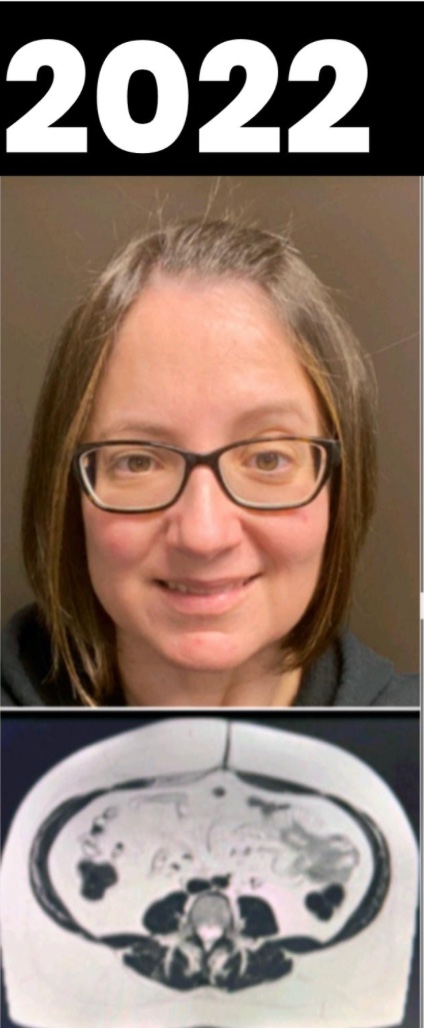 Dr. Ana Rosa Before photo