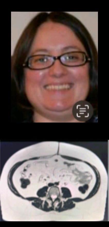 Dr. Ana Rosa Before photo