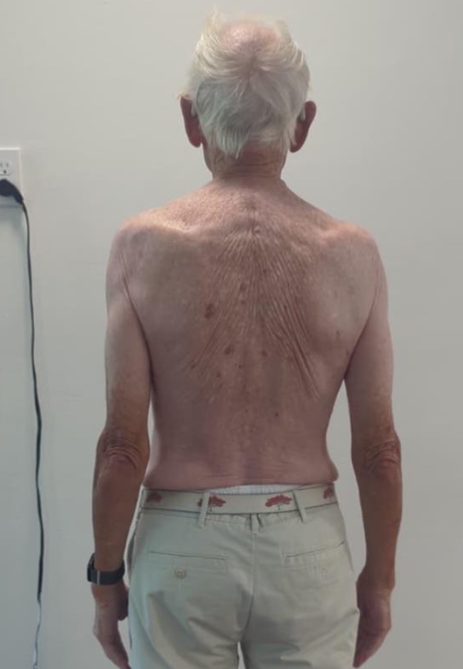 Don H. After photo