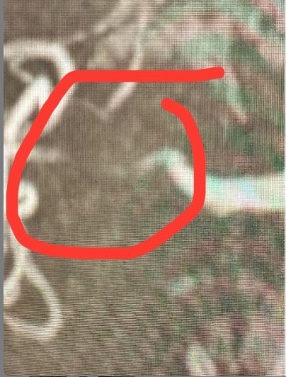 Henry L. Brain Before photo