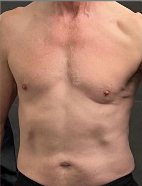 Iain S. After photo