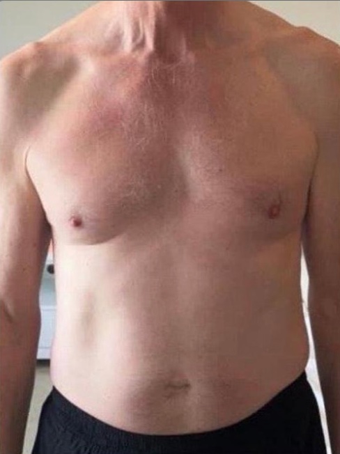 Iain S. Before photo