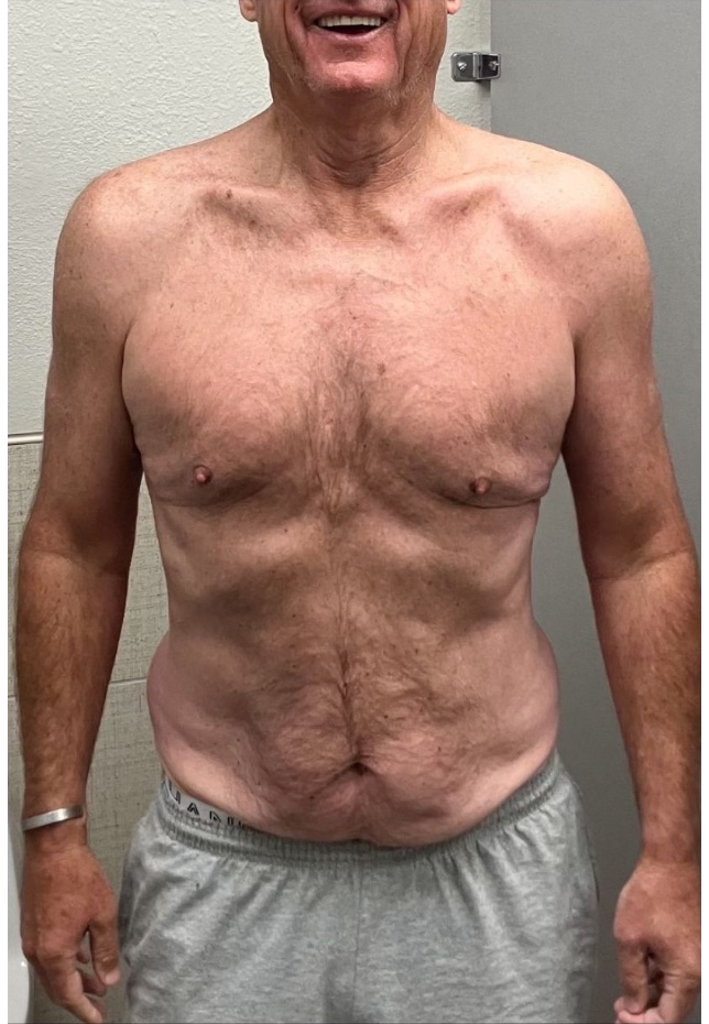 Joe O. Photo After photo