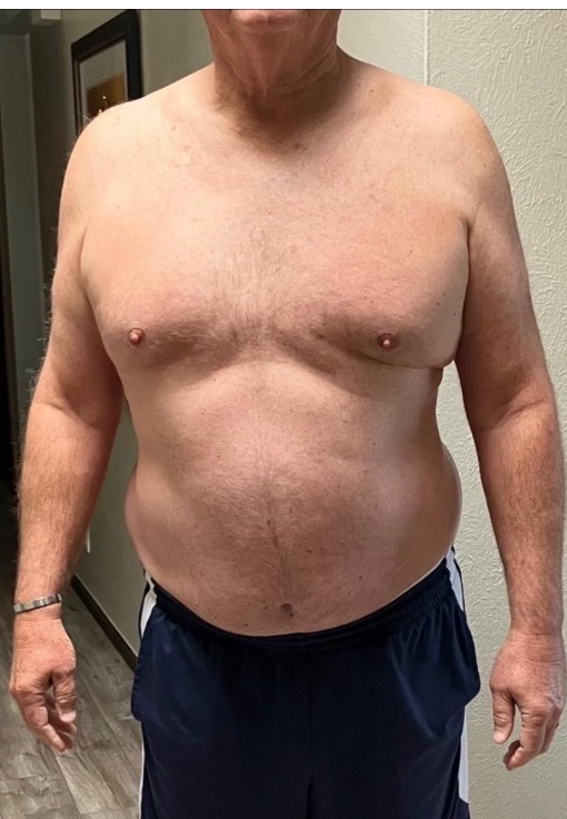 Joe O. Photo Before photo
